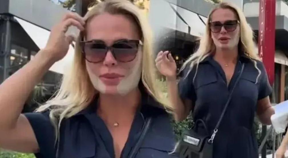 Survivor 2026 ikincisi Nagihan Karadere’den yeni paylaşım Estetik sonrası son hali dikkat çekti