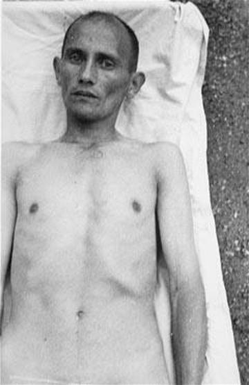 Tüyler ürpertici Nazi deneyleri