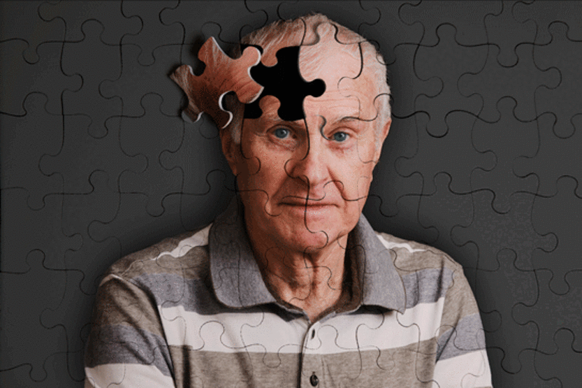 Alzheimer hastalığı tanısı nasıl konur