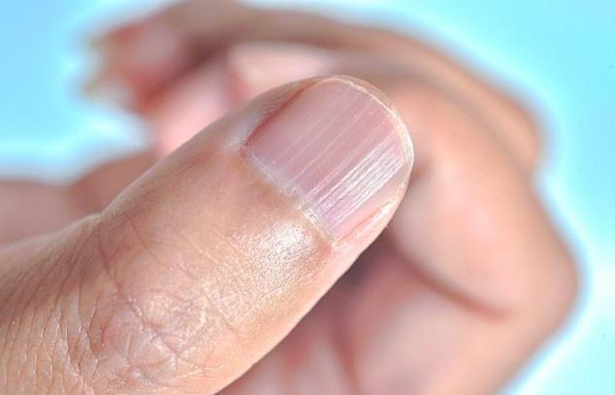 Vücudunuz size ne anlatmaya çalışıyor Bu belirtiler hastalığa işaret olabilir