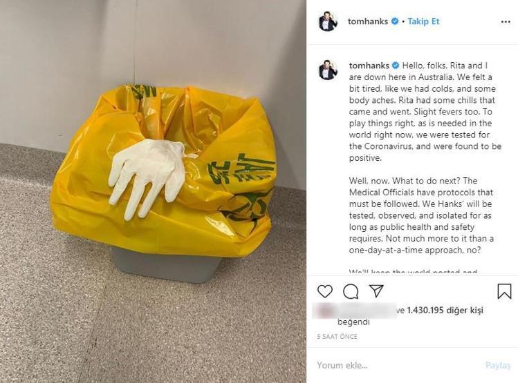 Son dakika... Ünlü oyuncu Tom Hanks ve eşi koronavirüse yakalandı