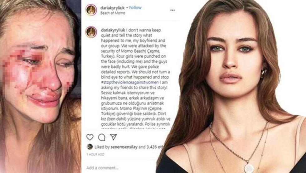 Ünlü modele saldırıda çifte şüphe: Polisler sevgilisini teşhis etti