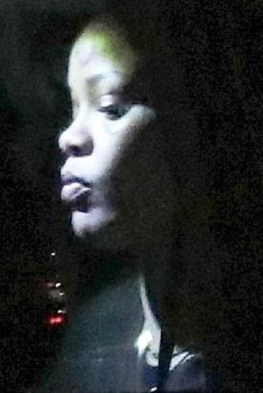 Rihanna yüzündeki morluklarla hayranlarını korkuttu
