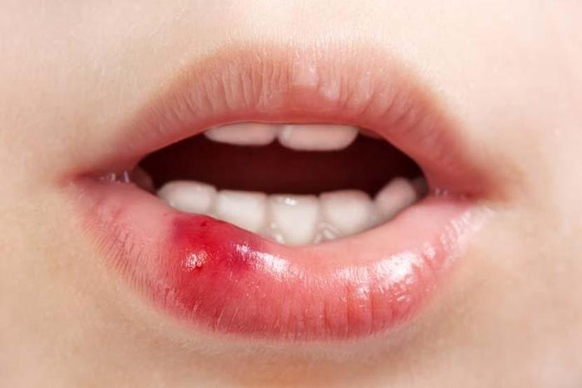 Bu 10 belirti gluten hassasiyetinin habercisi İşte vücudun tepkileri