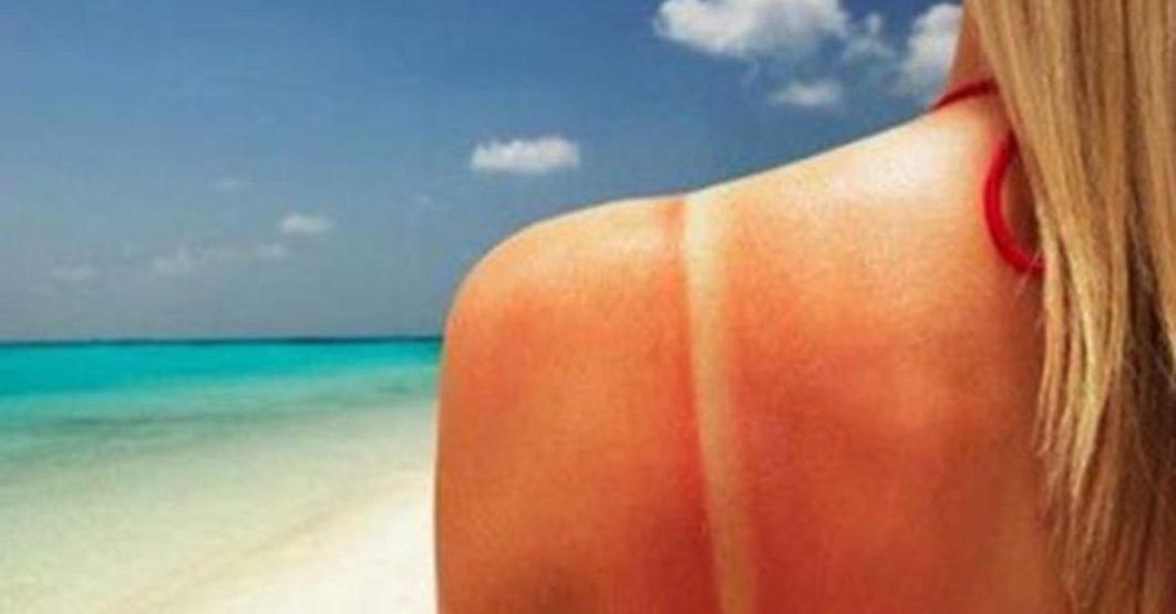 Uzmanından uyarı: Güneş ışınları cilt lekelerine davetiye çıkarıyor