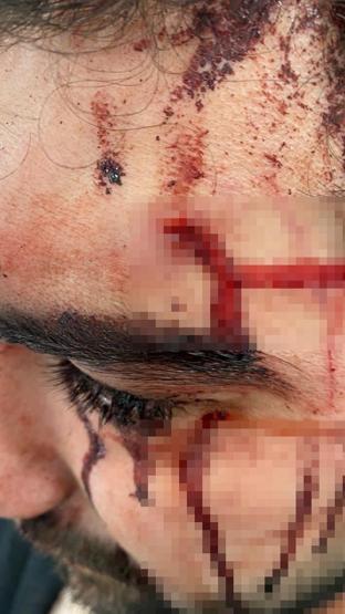 Üsküdar’da akraba dehşeti Asma kilitle kafasını yardılar