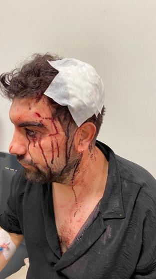 Üsküdar’da akraba dehşeti Asma kilitle kafasını yardılar