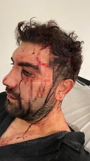 Üsküdar’da akraba dehşeti Asma kilitle kafasını yardılar