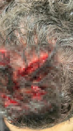 Üsküdar’da akraba dehşeti Asma kilitle kafasını yardılar