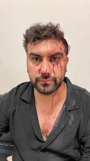 Üsküdar’da akraba dehşeti Asma kilitle kafasını yardılar