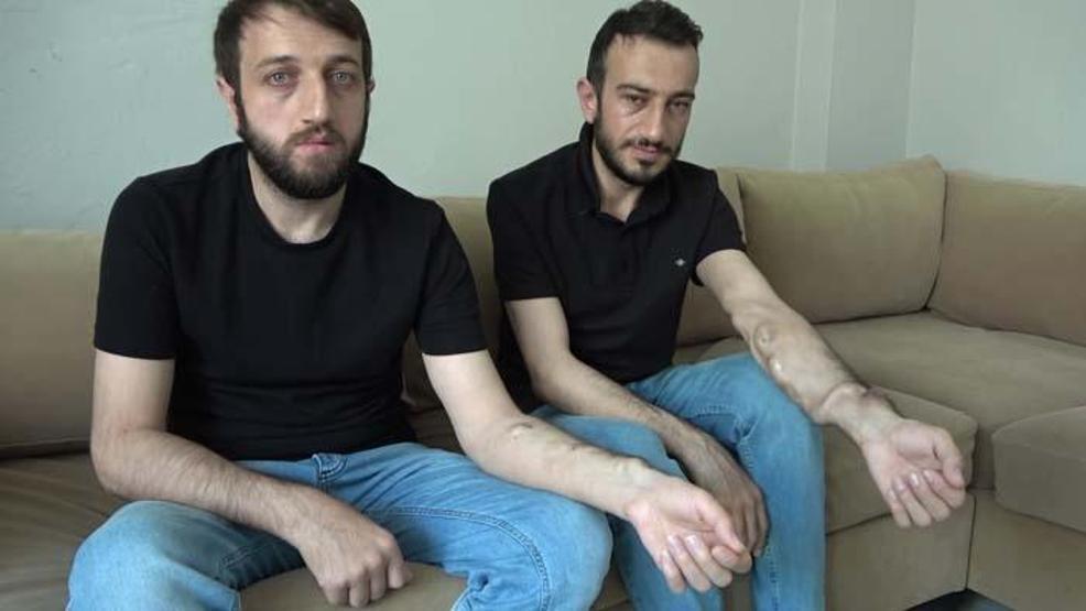 Sultanbeyli’de böbrek hastası iki kardeş yaklaşık 10 yıldır nakil bekliyor