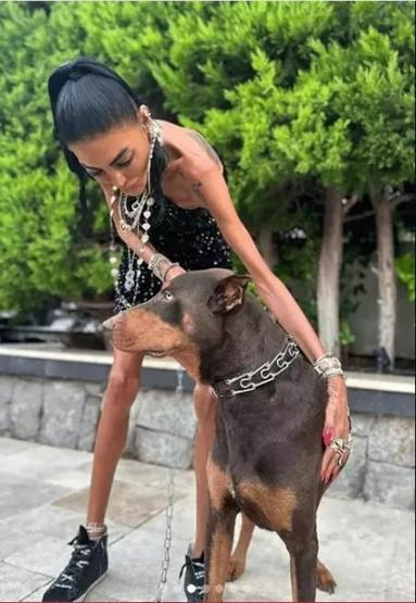 Süreyya Yalçına yanlış teşhis şoku Meğer kaburgaları kırılmış