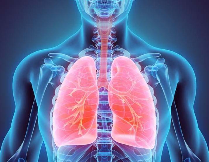 Asbest maruziyetinin yol açtığı hastalık: Mezotelyoma