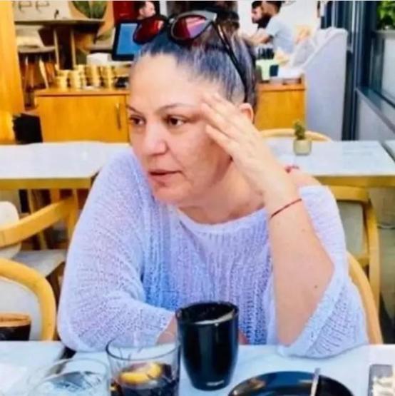 İzel fotoğrafına gelen yorumlara isyan etti: Yüzümdeki çukurların silinmesini istedim!