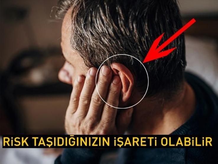 Kalp Krizinin En Erken Belirtisiymiş İşte Tehlikede Olduğunuzu Gösteren O İşaret..