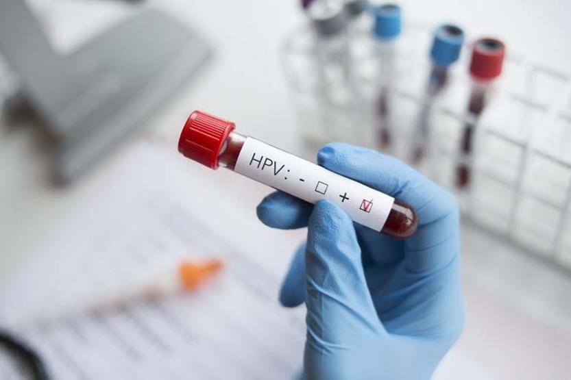 Sinsi ilerleyen HPV’ye karşı en etkili koz aşı