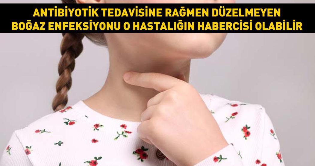 Antibiyotik tedavisine rağmen düzelmeyen boğaz enfeksiyonu bu hastalığın habercisi olabilir Kesin nedeni bilinmiyor