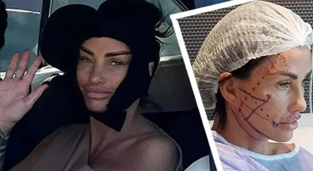 Kanlı kanlı havuza girince lüks otelde infial yaratmıştı Estetik yaptırmak için Türkiyeye gelen Katie Price ülkesinde gözaltına alındı