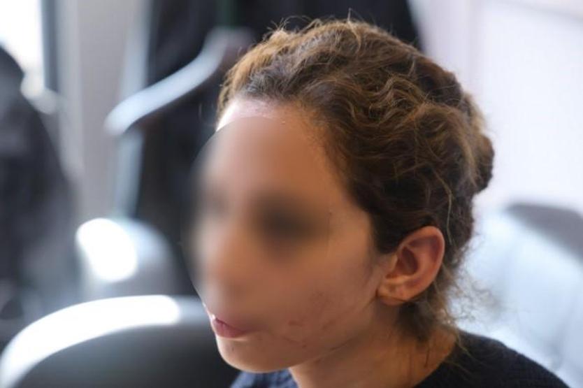 Ayrılmak İstedi Diye... Eski Sevgiliden Genç Kıza Darp Tuzağı