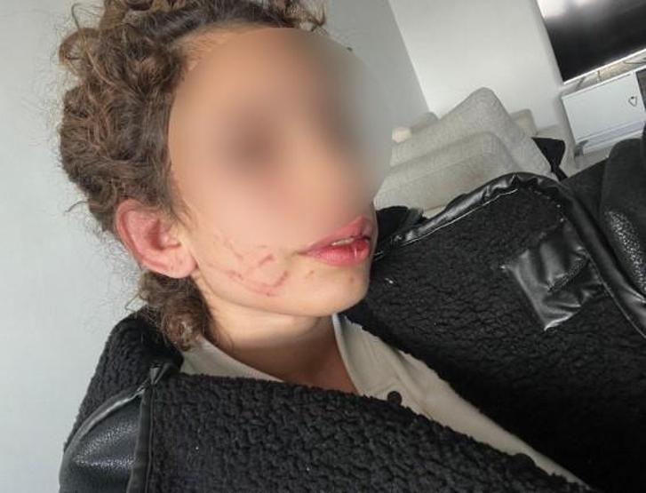 Ayrılmak İstedi Diye... Eski Sevgiliden Genç Kıza Darp Tuzağı