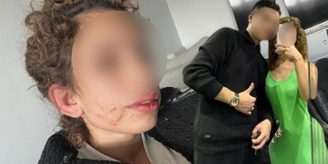 Ayrılmak İstedi Diye... Eski Sevgiliden Genç Kıza Darp Tuzağı
