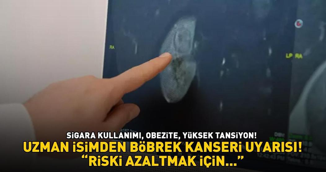 SESSİZ KATİL Uzman isimden böbrek kanseri uyarısı: ‘Riski azaltmak için…’