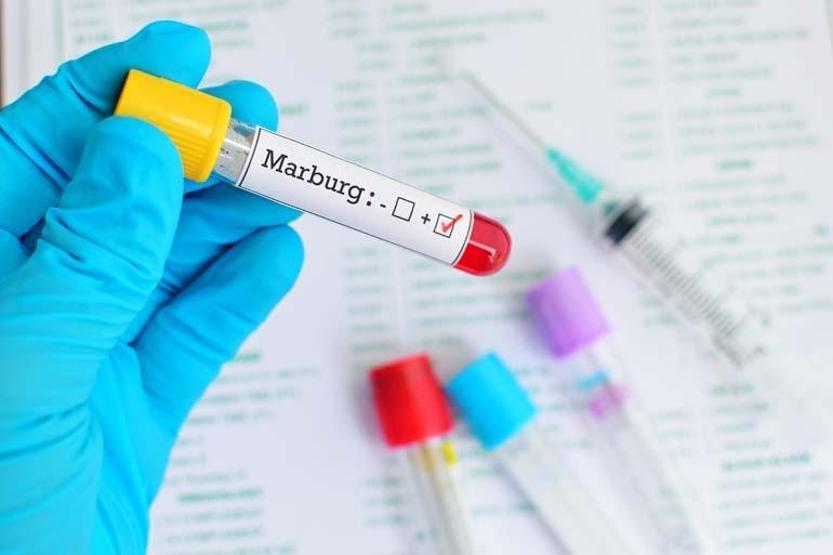 DSÖ: En Az 8 Kişi Hayatını Kaybetti Marburg Virüsü Nedir, Nasıl Bulaşıyor, Belirtileri Neler Marburg Virüsü Ne Kadar tehlikeli Marburg Virüsü Salgınlarının Görüldüğü Yerler