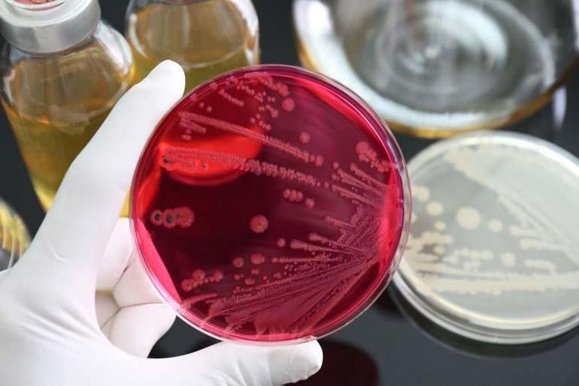 Salmonella bakterisine karşı uzmanından uyarı: “Genelde hayvansal gıdaların tüketilmesiyle oluşur”