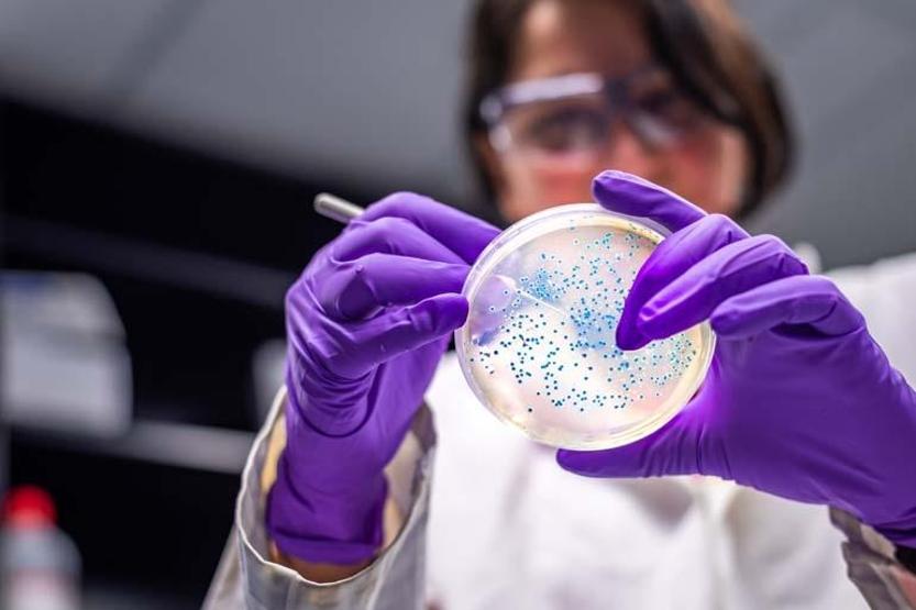 Salmonella bakterisine karşı uzmanından uyarı: “Genelde hayvansal gıdaların tüketilmesiyle oluşur”
