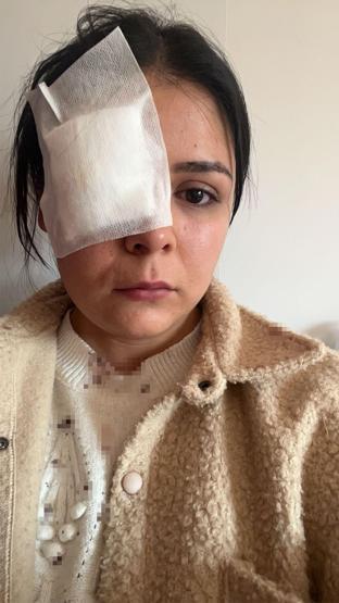 Yolda Yürürken Yumruklu Saldırıya Uğramıştı Genç Kadın Konuştu