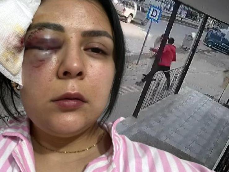 Yolda Yürürken Yumruklu Saldırıya Uğramıştı Genç Kadın Konuştu