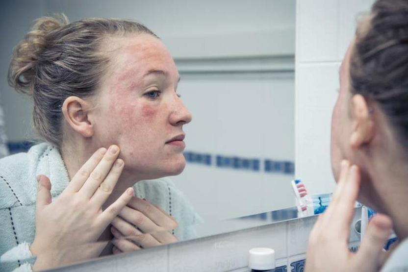 Bebek gibi bir cildin sırrını dermatolog verdi Mutlaka bu besini tüketin