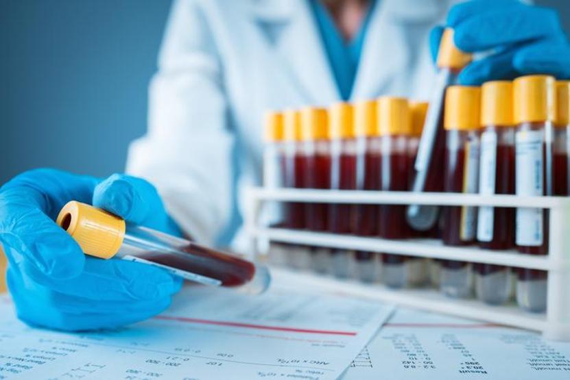 KANSERE EN YATKIN KAN GRUBU 50 bin katılımcı incelendi, sonuç şoke etti: Risk yüzde 55 daha fazla