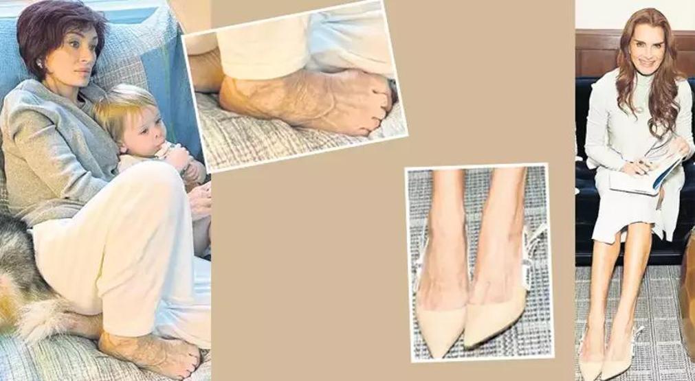 Ünlü yıldızların kullandığı zayıflama iğnelerinin yan etkisi ortaya çıktı: Ayakları bozuyor