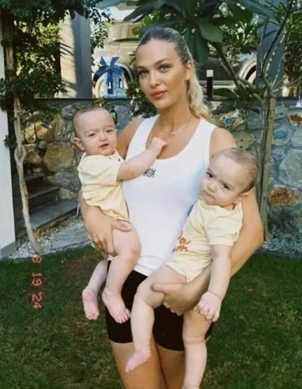 İkizleri operasyon geçirdi Yasemin Şefkatli son durumlarını açıkladı