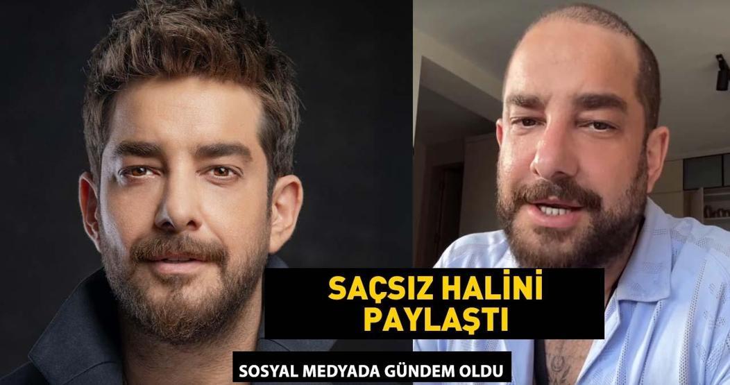 Enis Arıkanın saçsız hali gündem oldu Meğer protez saç kullanıyormuş