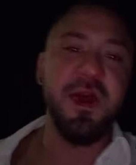 Selin Ciğercinin eski eşi Gökhan Çıraya saldırı şoku: Akan her kanım için hesap soracağım 10 kişi bir anda...
