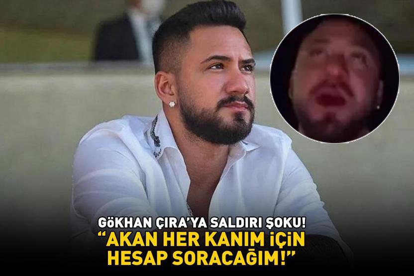 Selin Ciğercinin eski eşi Gökhan Çıraya saldırı şoku: Akan her kanım için hesap soracağım 10 kişi bir anda...