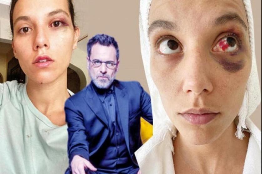 Ozan Güven’e Mahkemeden Şok Karar: Abajur Silahtan Sayıldı