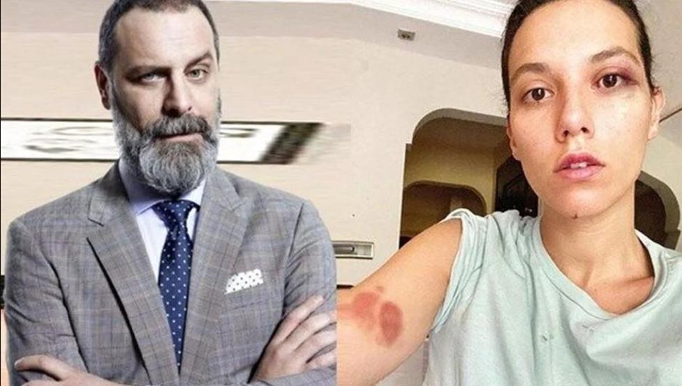 Ozan Güven’e Mahkemeden Şok Karar: Abajur Silahtan Sayıldı