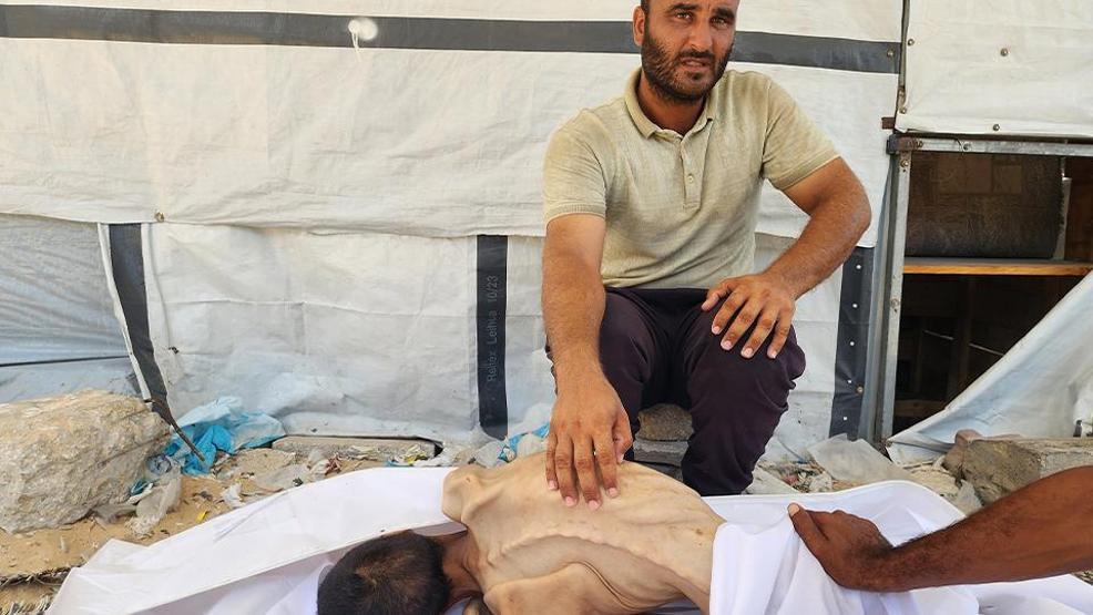 İsrail ablukasında Gazzede korkunç insani kriz: 27 yaşındaki genç yetersiz beslenme nedeniyle yaşamını yitirdi