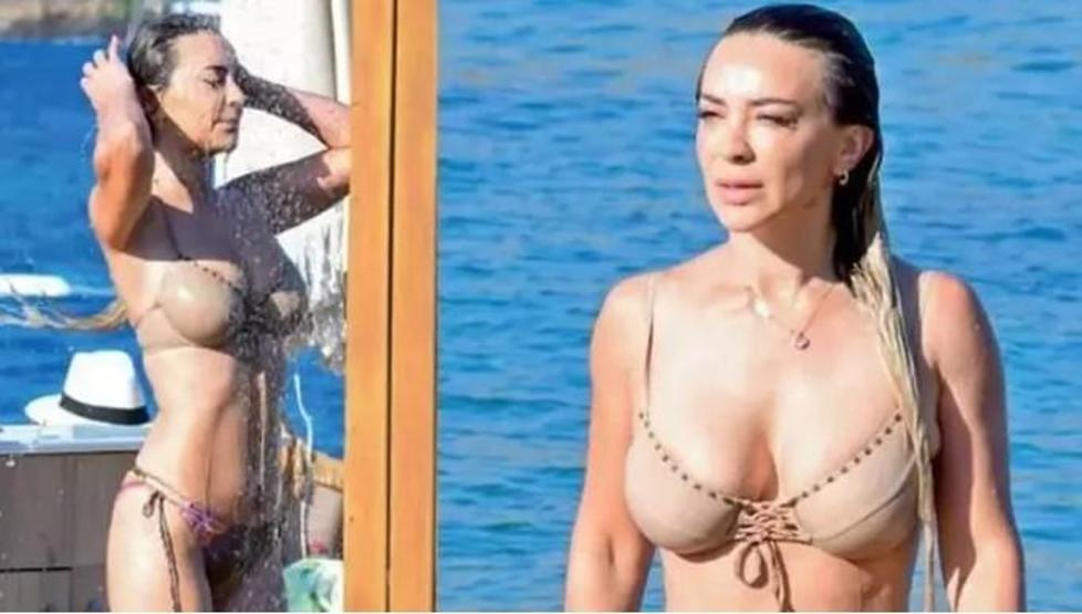 Pınar Yıldız, Attan Düşüp Hafızasını Kaybettikten Sonra İlk Kez Konuştu