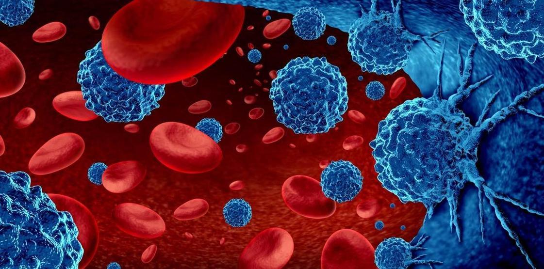Uzman İsim Açıkladı: Akut Lösemi Erken Teşhisle Yenilebilir