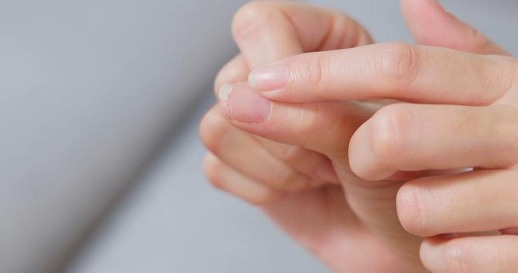 Hem tırnakları güçlendiriyor hem de etleri nemlendiriyor Hazırlaması çok kolay: İşte 4 malzemeli basit karışım