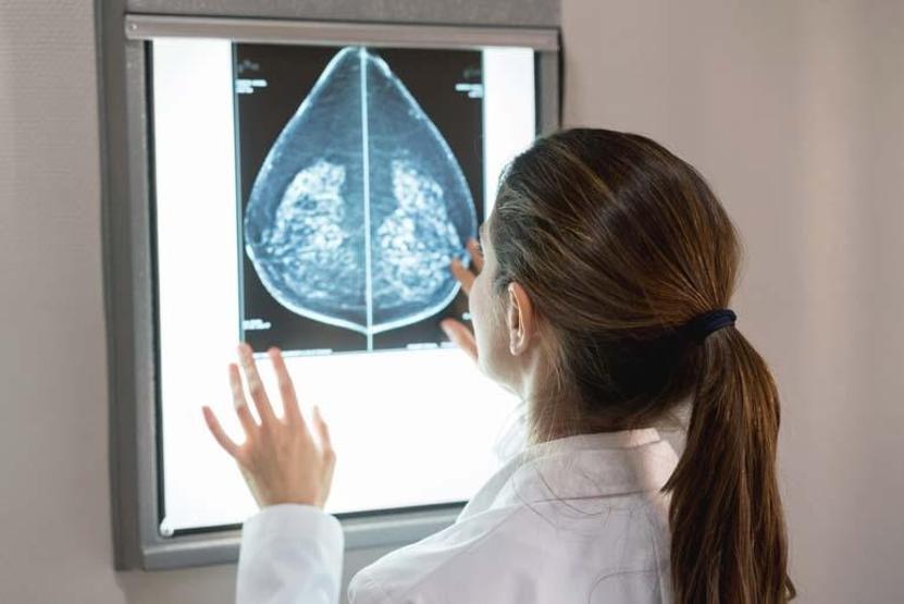 Kadınlar Arasında En Yaygın Kanser Türü Yeni Araştırma Korkuttu: Vakalar 2050’ye Kadar 3,5 Milyona Çıkabilir