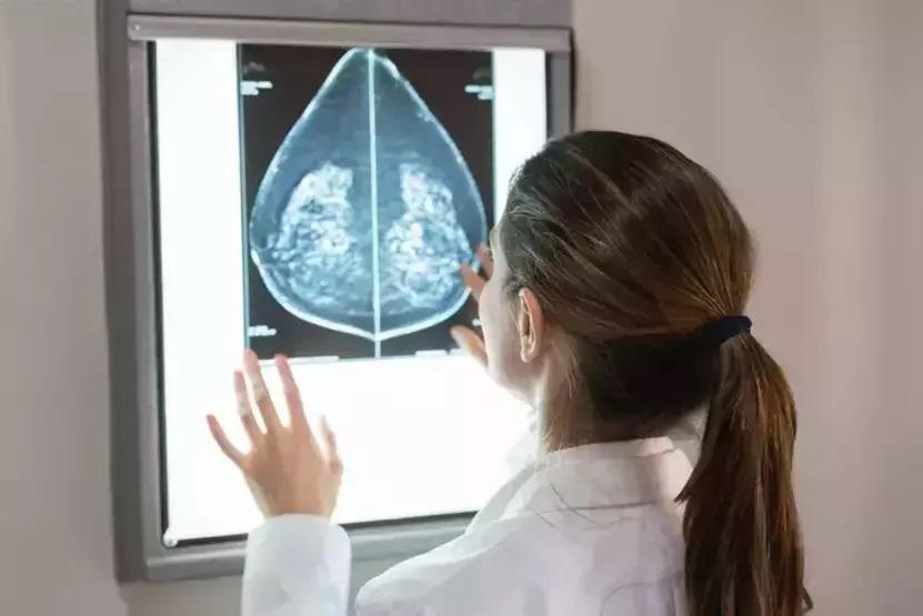 Göğsünde tümör tespit edilmişti Tülin Şahinin patoloji sonucu çıktı Her 8 kadından birinde görülüyor: Erken tanı hayat kurtarıyor