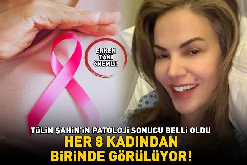 Göğsünde tümör tespit edilmişti Tülin Şahinin patoloji sonucu çıktı Her 8 kadından birinde görülüyor: Erken tanı hayat kurtarıyor