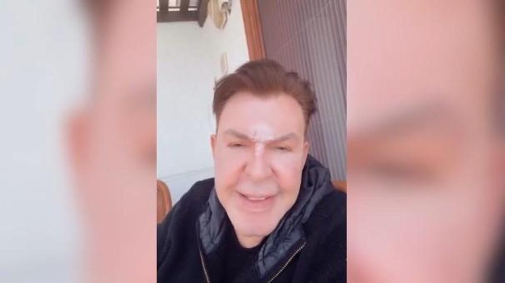 Yüz Gerdirme Ameliyatı Olan Kuşum Aydın Son Halini Paylaştı