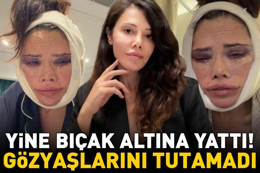 Yüz nakli olan Survivor Didem Ceran, bir kez daha bıçak altına yattı Gözyaşlarını tutamadı