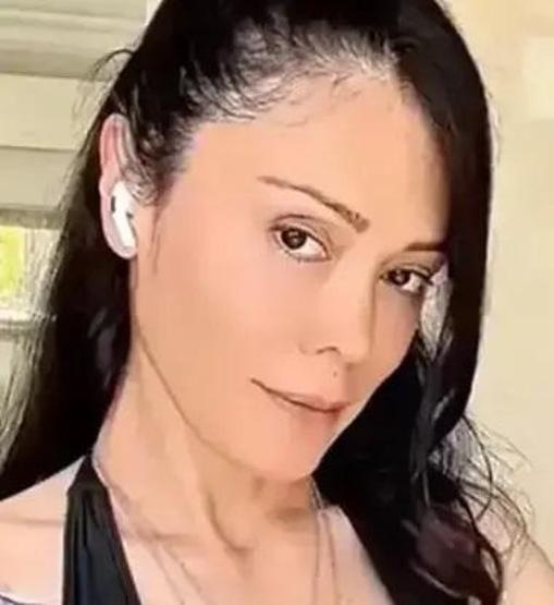 Yüz nakli olan Survivor Didem Ceran, bir kez daha bıçak altına yattı Gözyaşlarını tutamadı